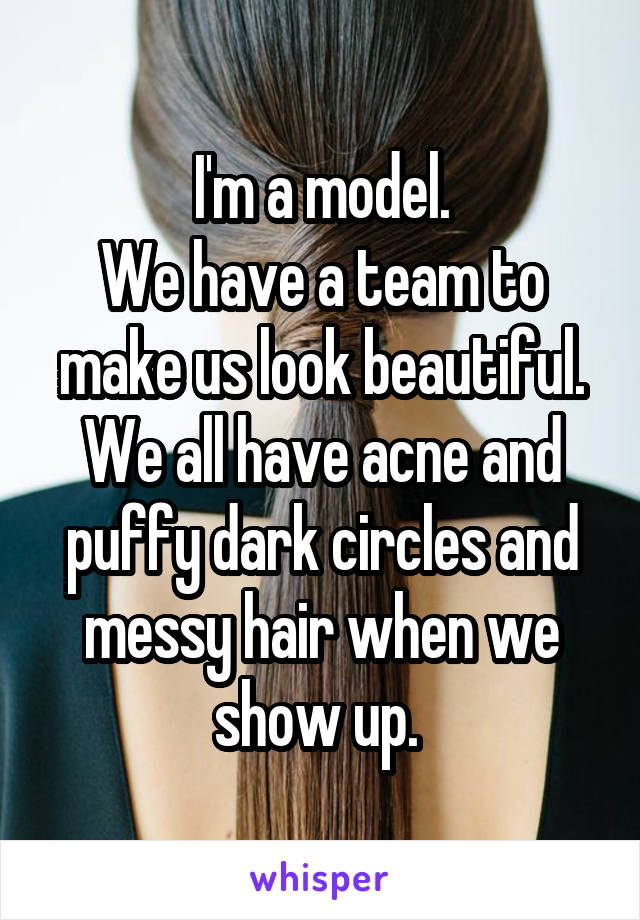 I'm a model.
We have a team to make us look beautiful.
We all have acne and puffy dark circles and messy hair when we show up. 