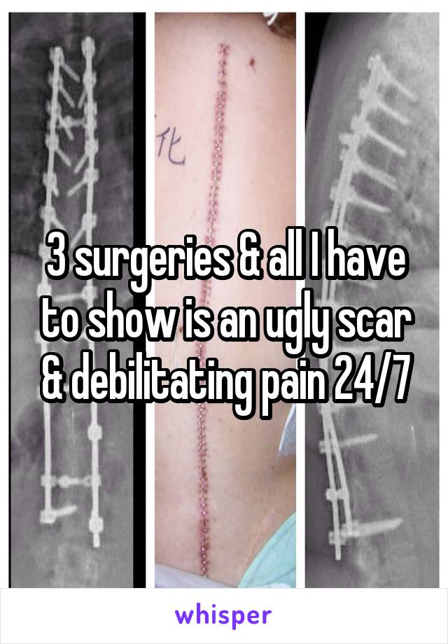 3 surgeries & all I have to show is an ugly scar & debilitating pain 24/7