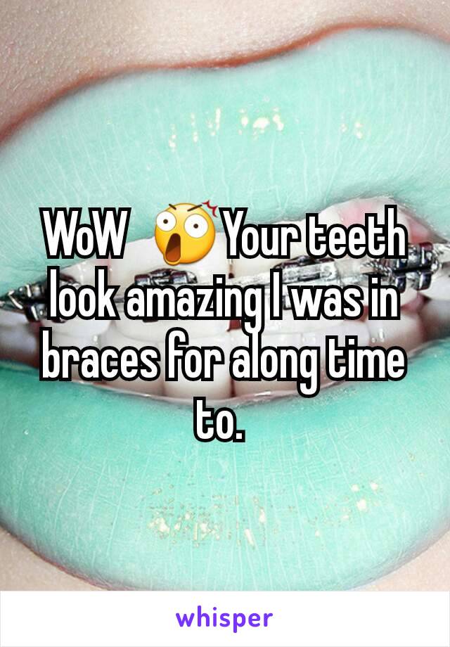 WoW  😲Your teeth look amazing I was in braces for along time to. 