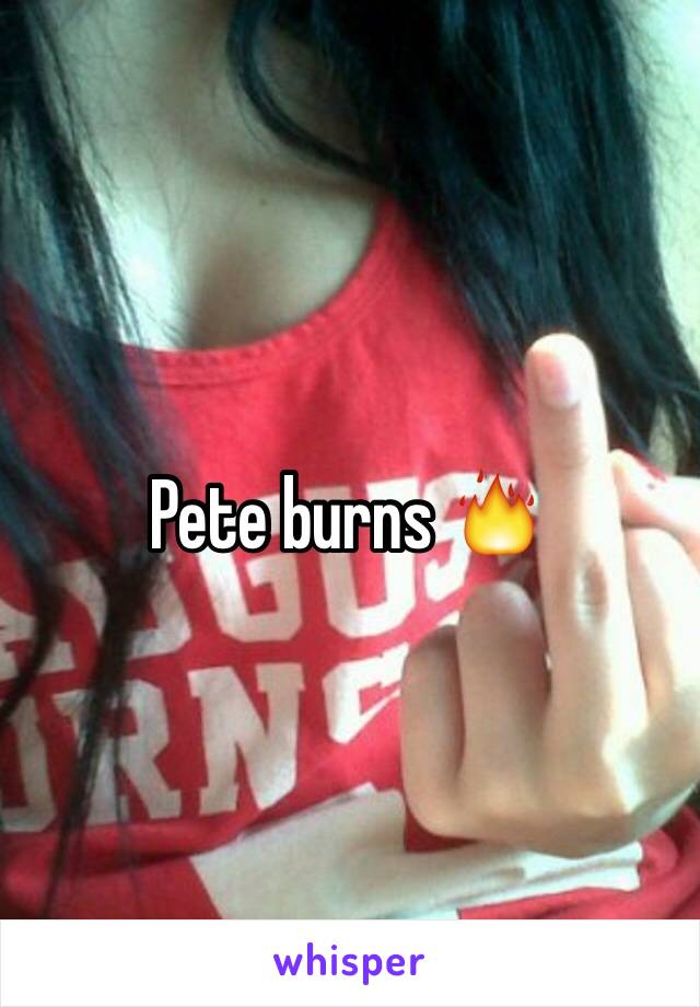 Pete burns 🔥