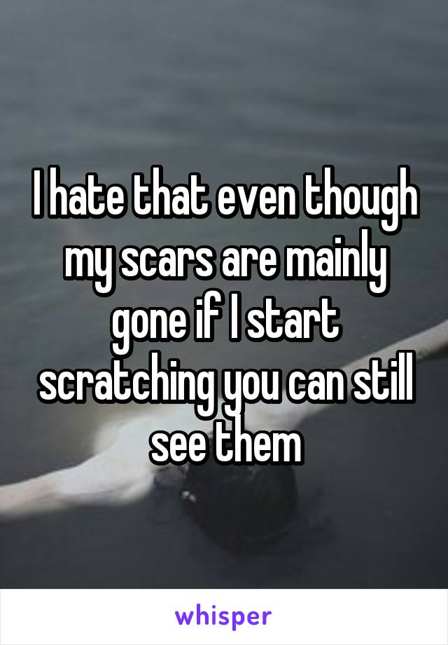 I hate that even though my scars are mainly gone if I start scratching you can still see them