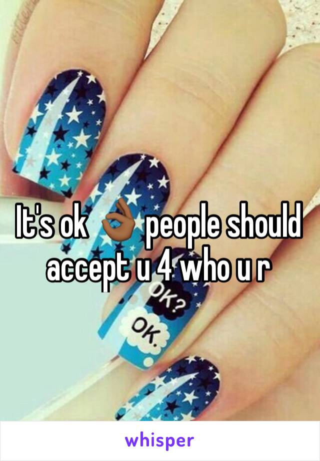 It's ok 👌🏾 people should accept u 4 who u r