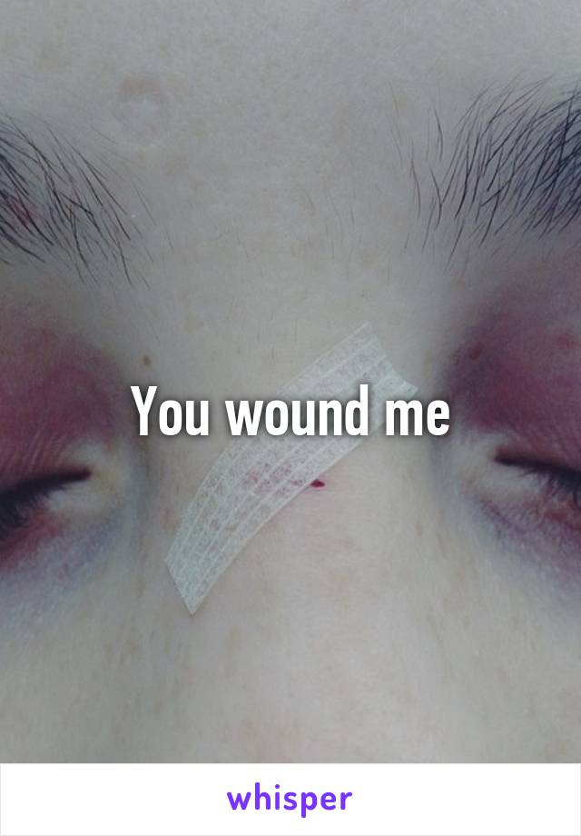 You wound me