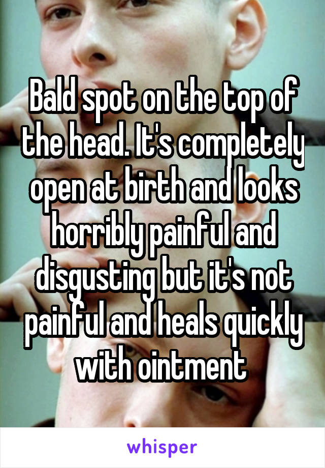 Bald spot on the top of the head. It's completely open at birth and looks horribly painful and disgusting but it's not painful and heals quickly with ointment 