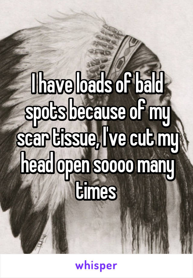 I have loads of bald spots because of my scar tissue, I've cut my head open soooo many times 