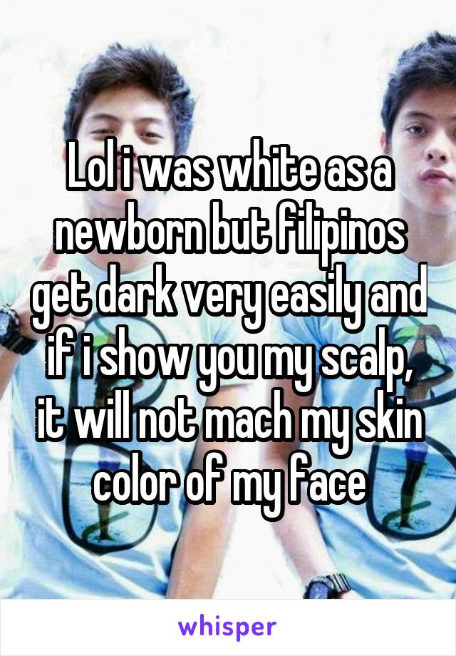 Lol i was white as a newborn but filipinos get dark very easily and if i show you my scalp, it will not mach my skin color of my face