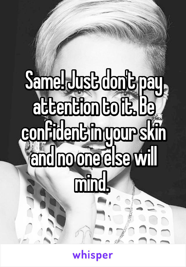 Same! Just don't pay attention to it. Be confident in your skin and no one else will mind. 