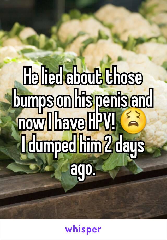 He lied about those bumps on his penis and now I have HPV! 😫
I dumped him 2 days ago.