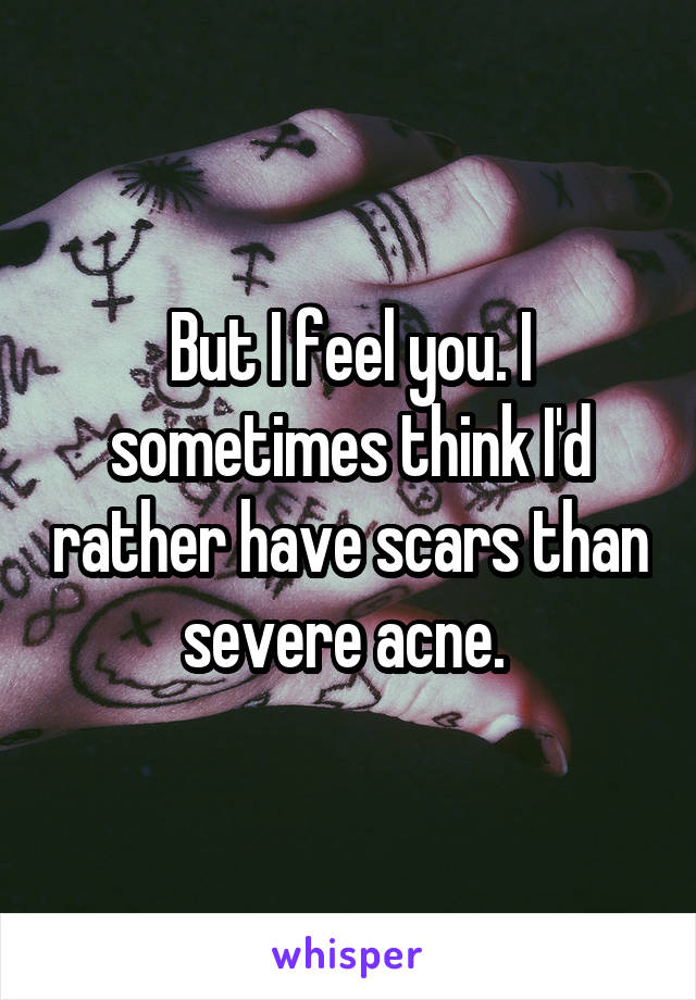 But I feel you. I sometimes think I'd rather have scars than severe acne. 