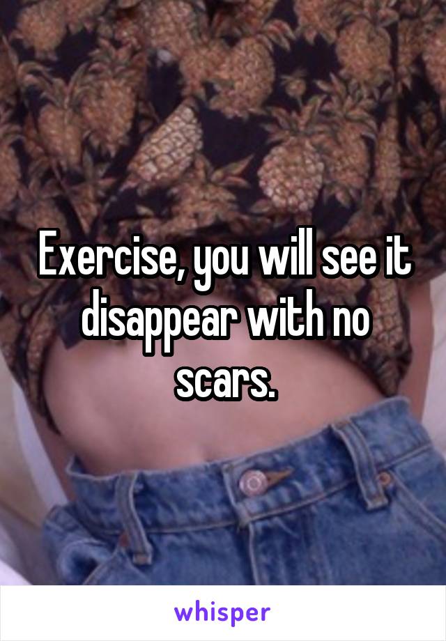 Exercise, you will see it disappear with no scars.