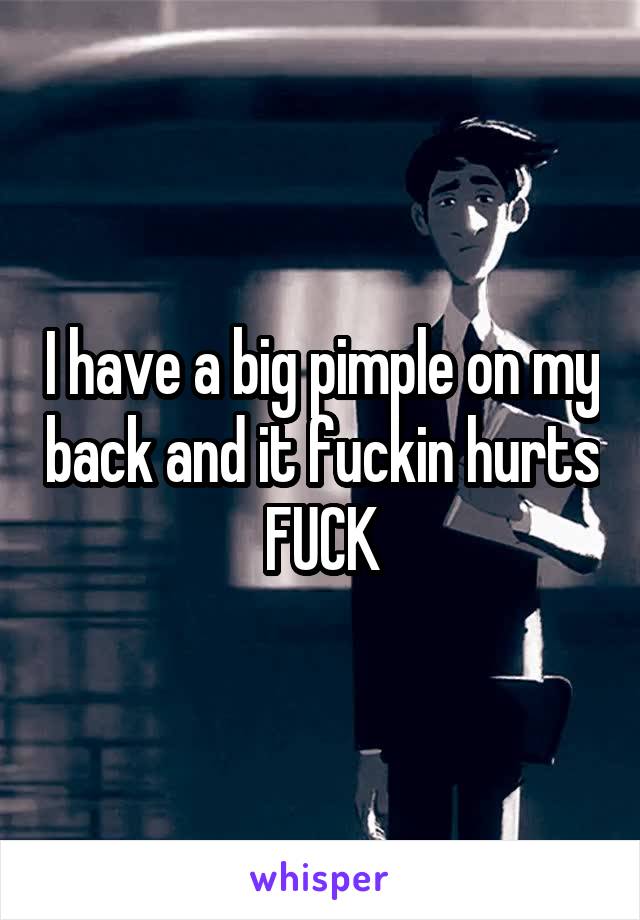 I have a big pimple on my back and it fuckin hurts FUCK