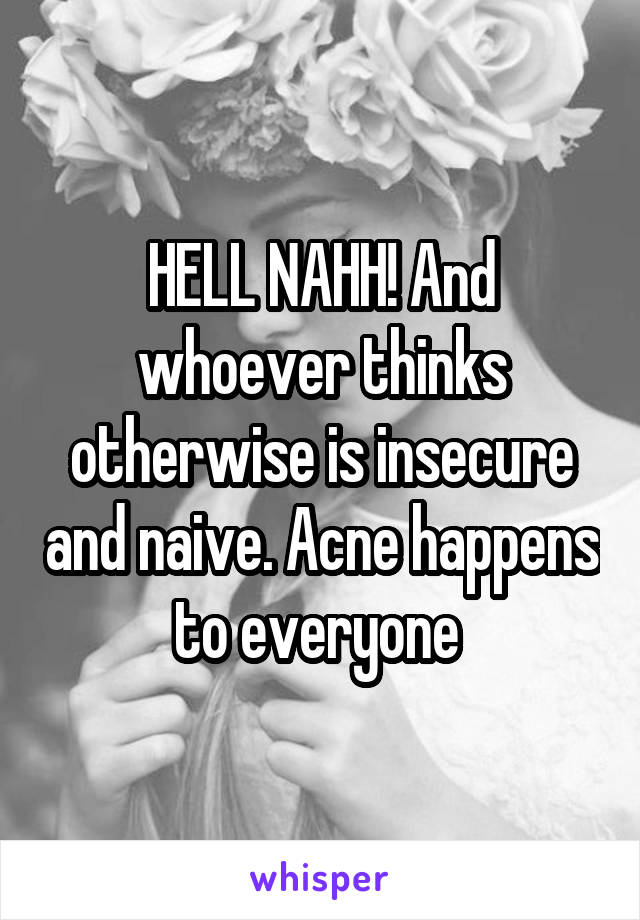 HELL NAHH! And whoever thinks otherwise is insecure and naive. Acne happens to everyone 