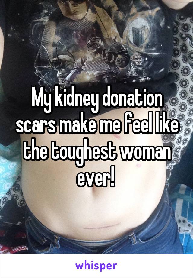 My kidney donation scars make me feel like the toughest woman ever! 