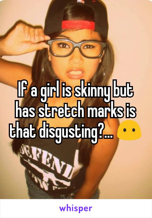 If a girl is skinny but has stretch marks is that disgusting?... 😶