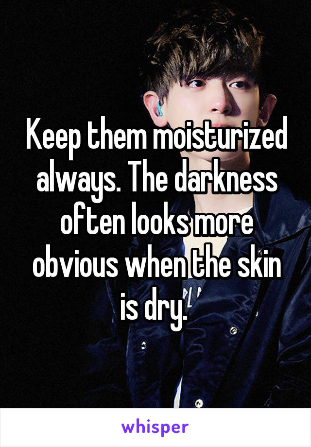 Keep them moisturized always. The darkness often looks more obvious when the skin is dry. 