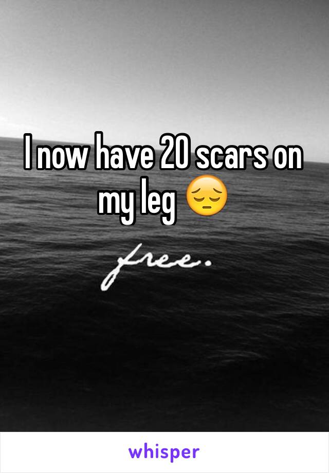 I now have 20 scars on my leg 😔