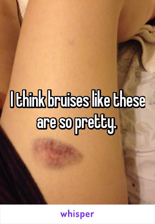 I think bruises like these are so pretty. 