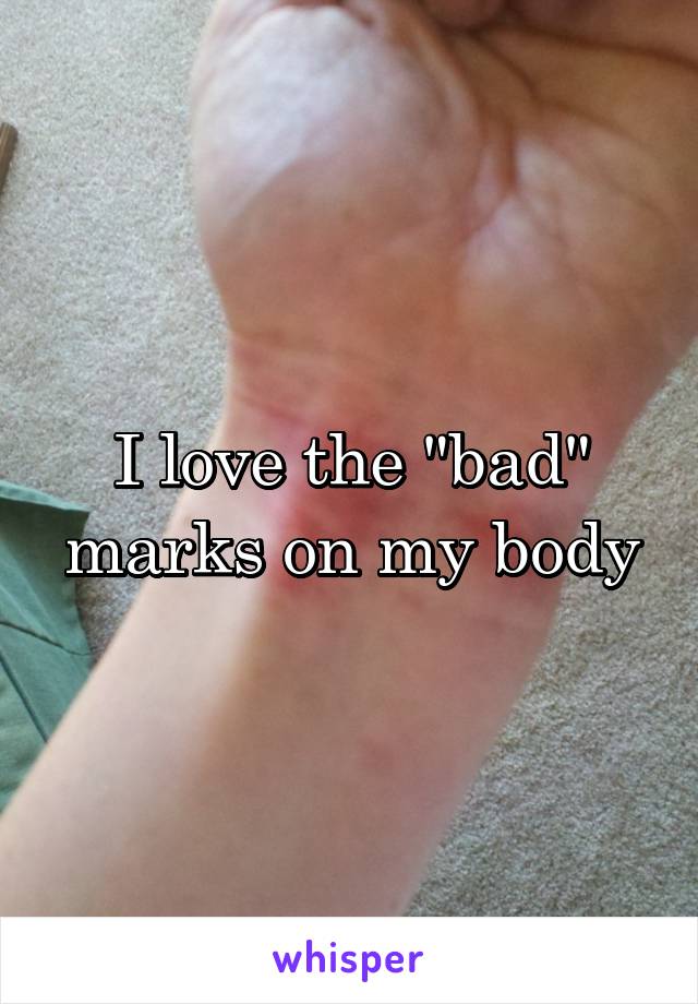 I love the "bad" marks on my body