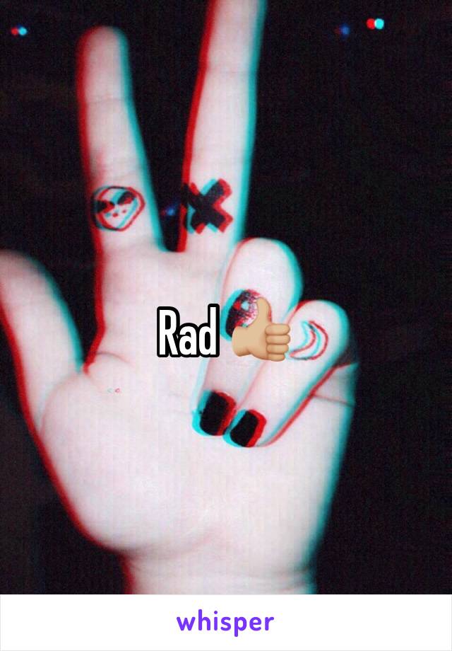 Rad 👍🏼