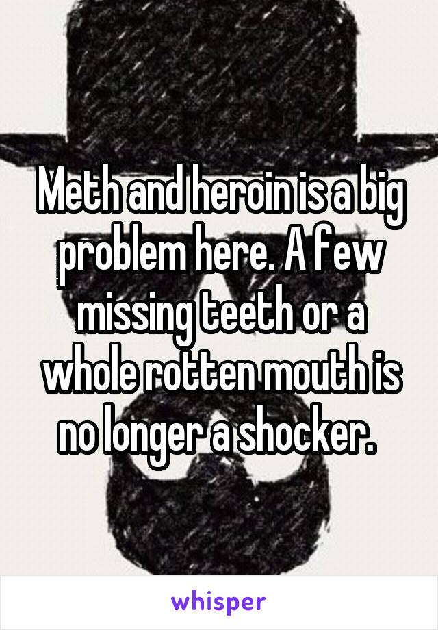 Meth and heroin is a big problem here. A few missing teeth or a whole rotten mouth is no longer a shocker. 