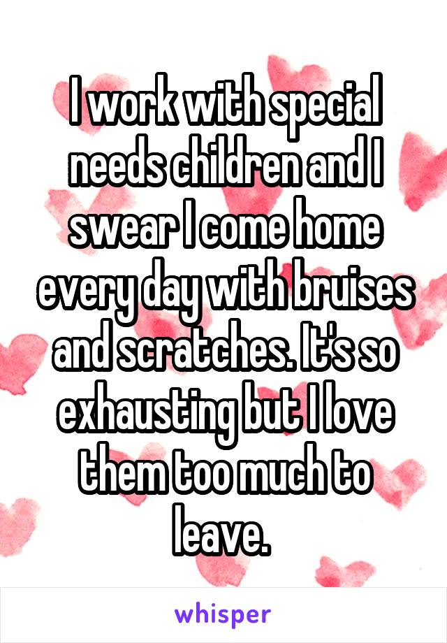 I work with special needs children and I swear I come home every day with bruises and scratches. It's so exhausting but I love them too much to leave. 