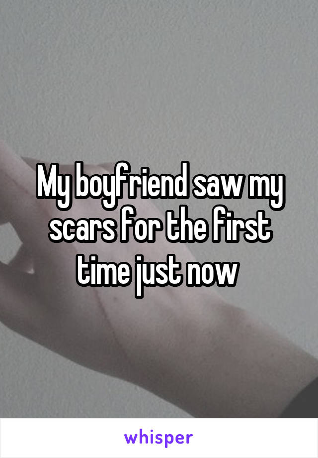 My boyfriend saw my scars for the first time just now 