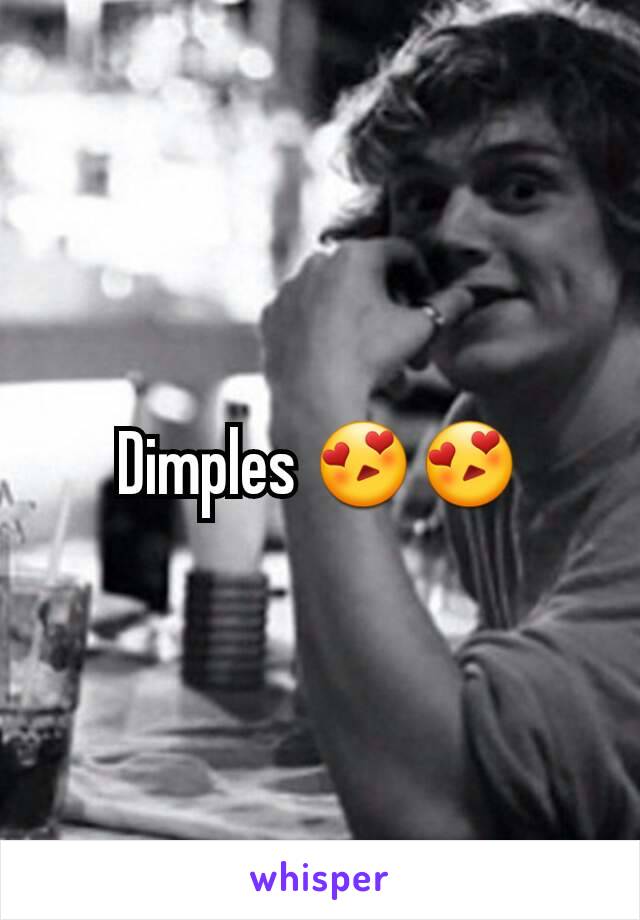 Dimples 😍😍