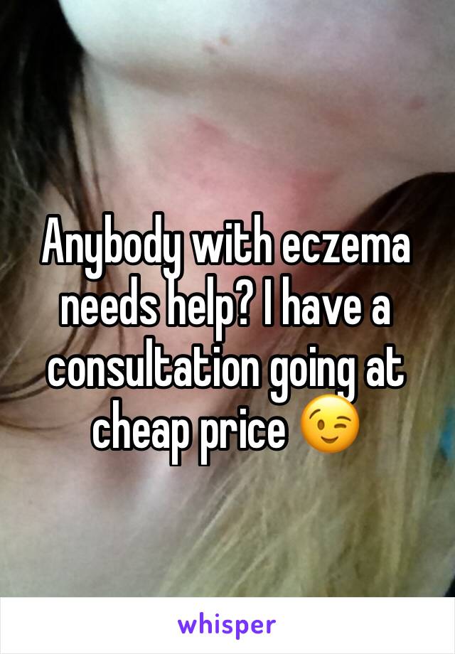 Anybody with eczema needs help? I have a consultation going at cheap price 😉