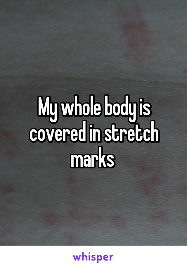 My whole body is covered in stretch marks 