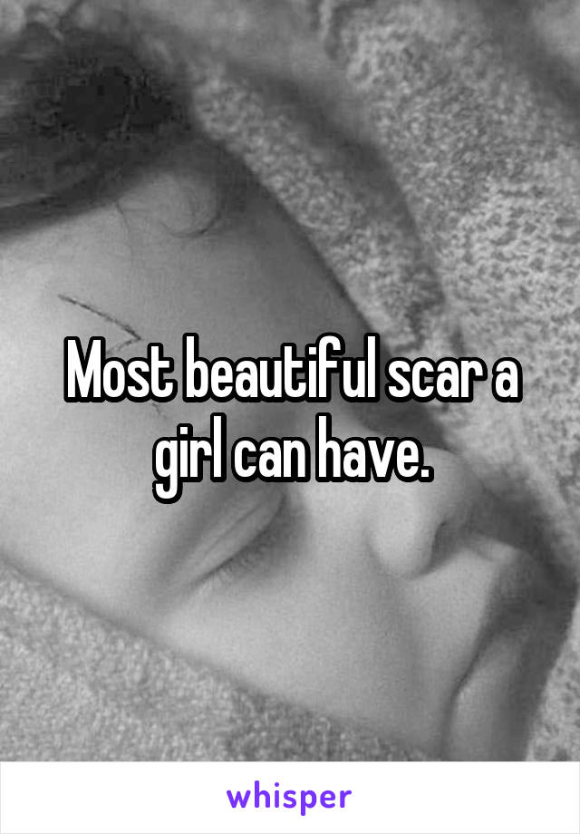 Most beautiful scar a girl can have.