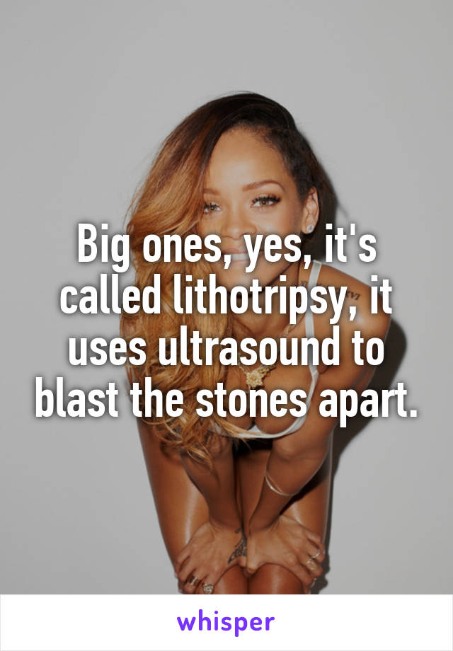 Big ones, yes, it's called lithotripsy, it uses ultrasound to blast the stones apart.