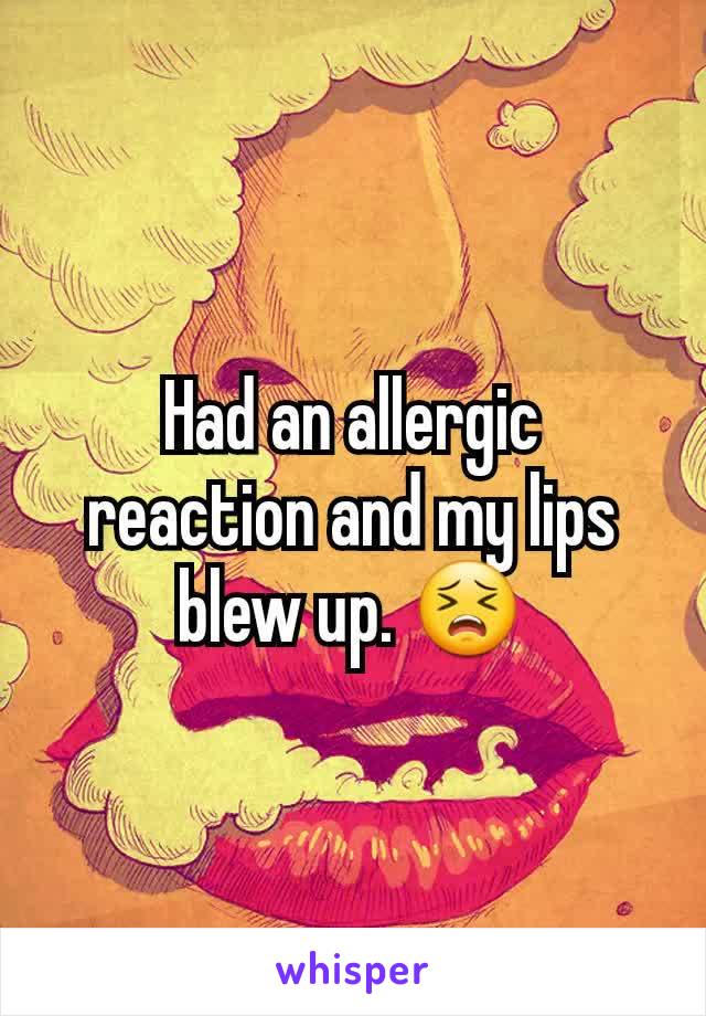 Had an allergic reaction and my lips blew up. 😣