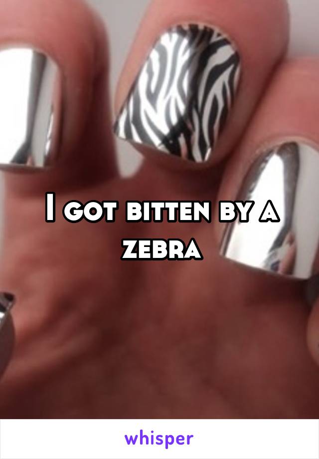 I got bitten by a zebra
