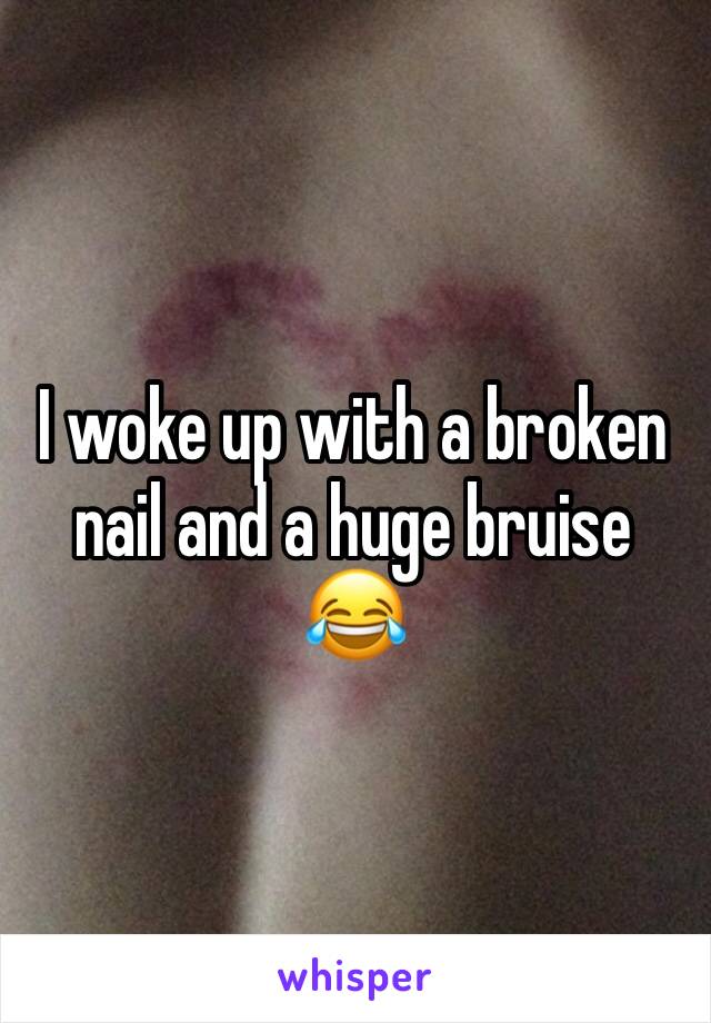 I woke up with a broken nail and a huge bruise 😂