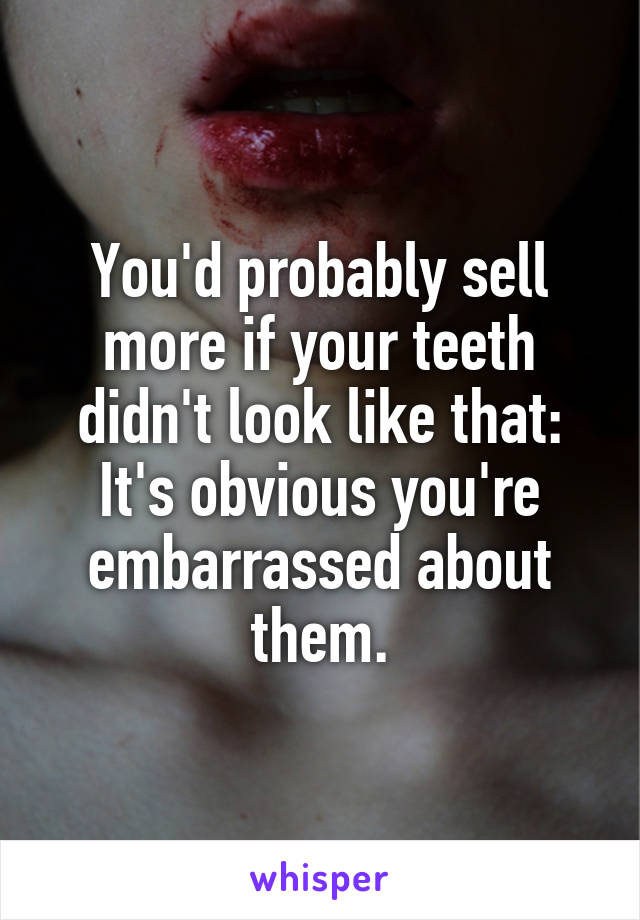 You'd probably sell more if your teeth didn't look like that: It's obvious you're embarrassed about them.
