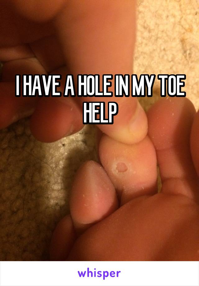 I HAVE A HOLE IN MY TOE HELP


