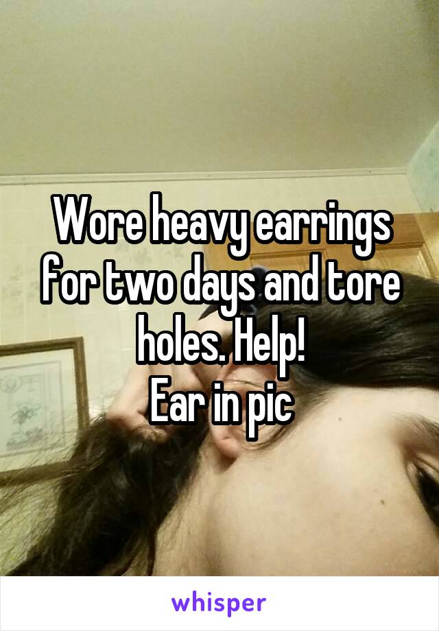 Wore heavy earrings for two days and tore holes. Help!
Ear in pic