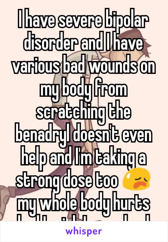 I have severe bipolar disorder and I have various bad wounds on my body from scratching the benadryl doesn't even help and I'm taking a strong dose too 😥 my whole body hurts bad I wish I was dead