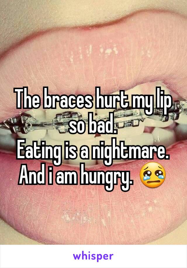 The braces hurt my lip so bad.
Eating is a nightmare.
And i am hungry. 😢