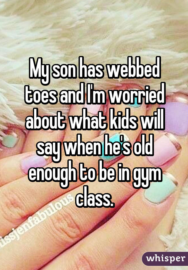 My son has webbed toes and I'm worried about what kids will say when he's old enough to be in gym class.