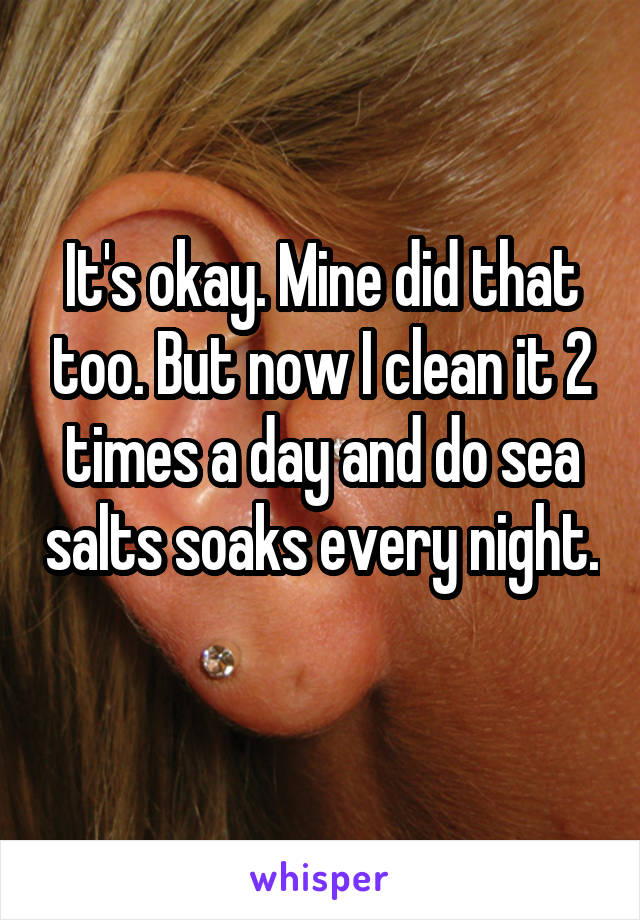 It's okay. Mine did that too. But now I clean it 2 times a day and do sea salts soaks every night. 