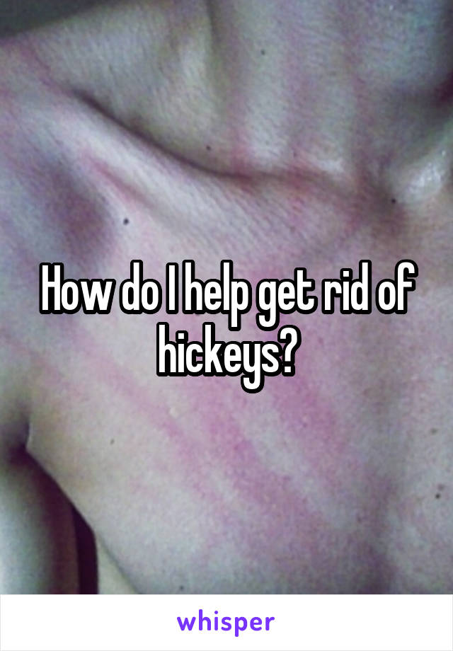 How do I help get rid of hickeys?