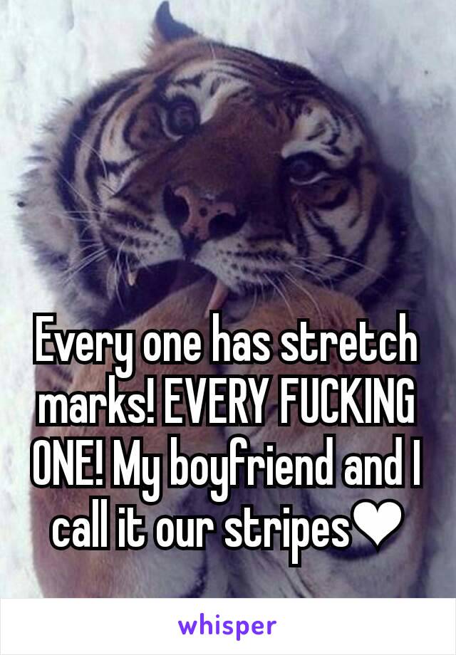 Every one has stretch marks! EVERY FUCKING ONE! My boyfriend and I call it our stripes❤