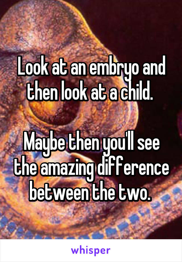 Look at an embryo and then look at a child. 

Maybe then you'll see the amazing difference between the two. 