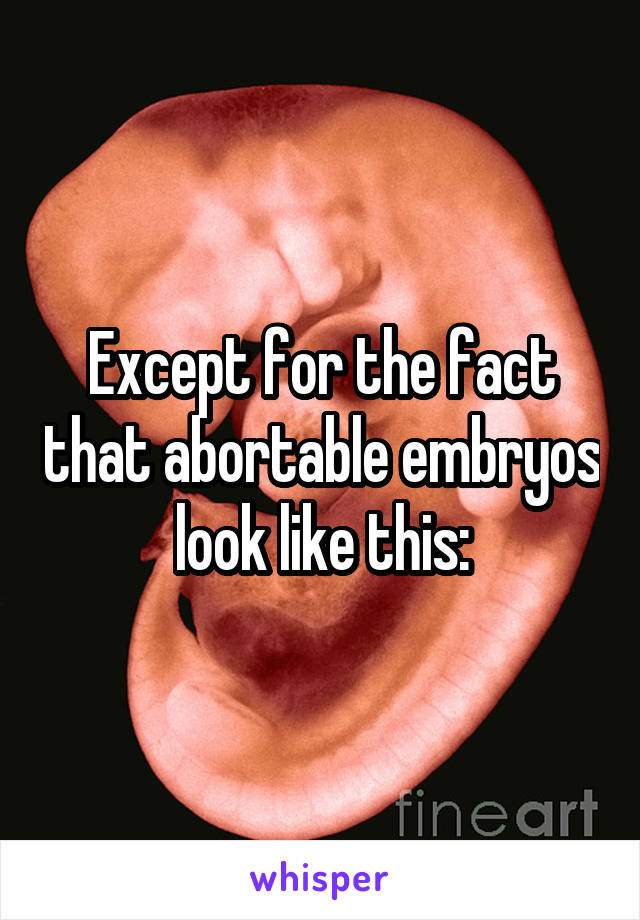 Except for the fact that abortable embryos look like this: