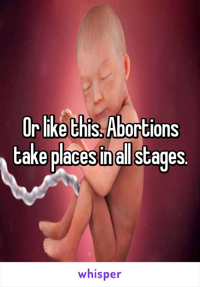 Or like this. Abortions take places in all stages.