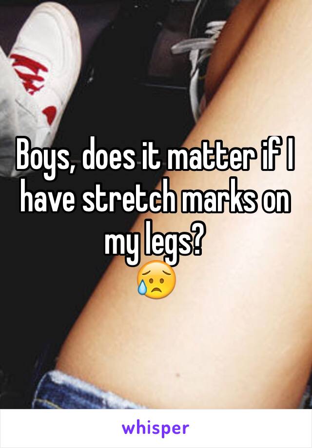 Boys, does it matter if I have stretch marks on my legs? 
😥