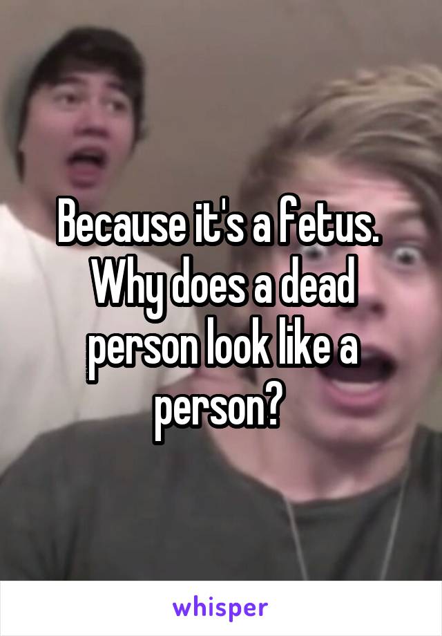 Because it's a fetus. 
Why does a dead person look like a person? 