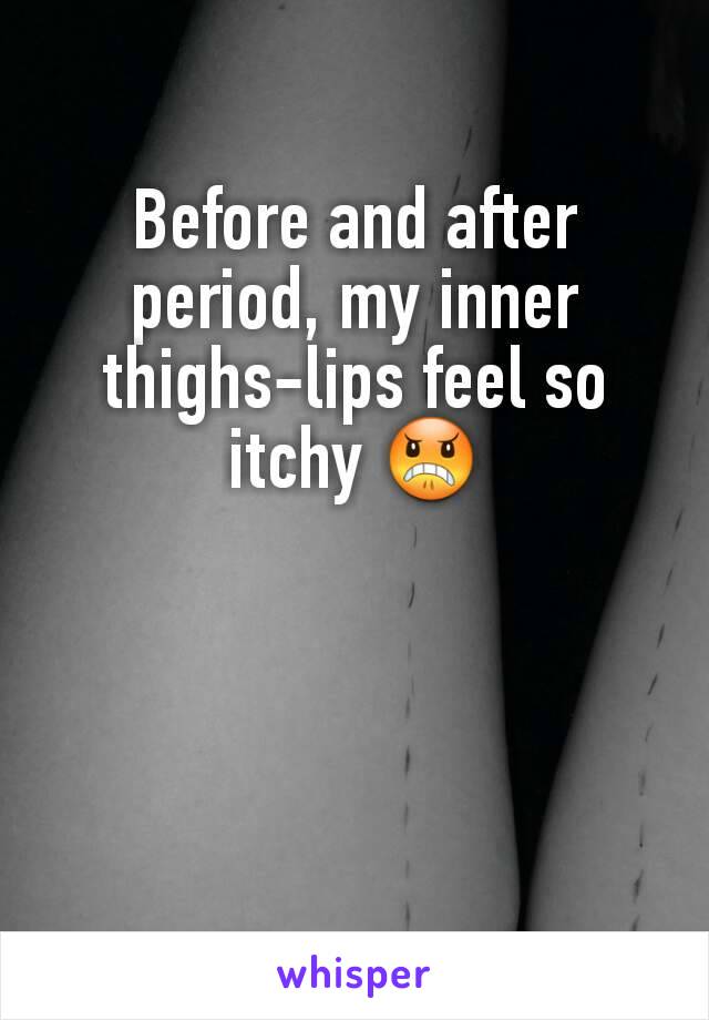 Before and after period, my inner thighs-lips feel so itchy 😠