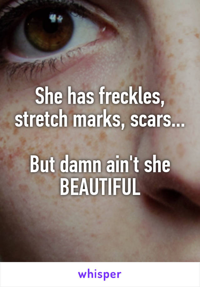 She has freckles, stretch marks, scars...

But damn ain't she BEAUTIFUL